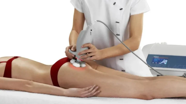 tratamientos-rollaction